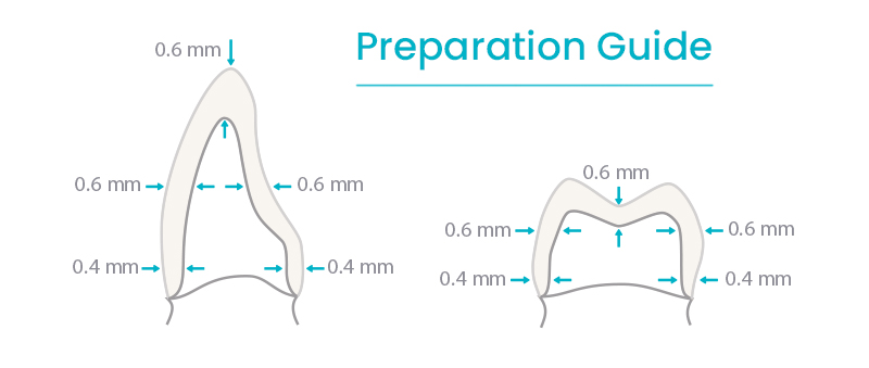 g-cam preparation guide chart