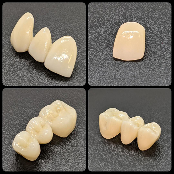 zirconium uses in dentistry