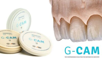 What is G-CAM & when should you prescribe it?