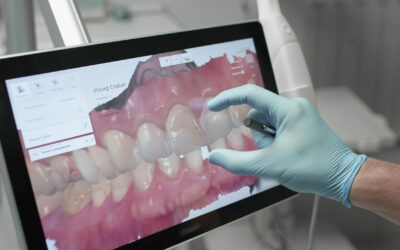 Get your dentures faster via intraoral scan